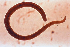 Кишечные паразиты в увеличении под микроскопом