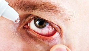 Лечение катаракты и дистрофических изменений сетчатки