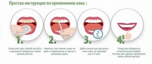 Средства для отбеливания зубов