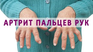 Заболевания способствующие полиартриту рук