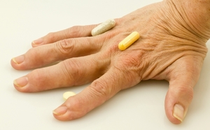 Медикаментозное лечение полиартрита рук